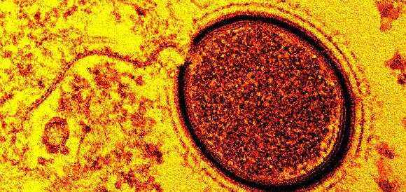 瑞士碾压莱比锡红牛,穆勒打破历史纪录 瑞士碾压莱比锡红牛,穆勒打破历史纪录